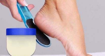 ¿Cómo quitar la resequedad de los pies con vaselina? Así puedes aplicarla sobre talones resecos y agrietados