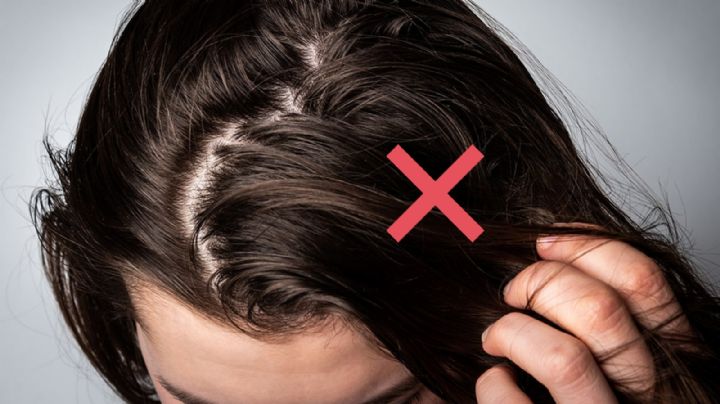 Trucos para eliminar el cabello graso sin ir a la peluquería