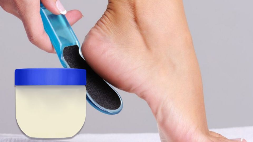 La vaselina combate la resequedad en lo pies.