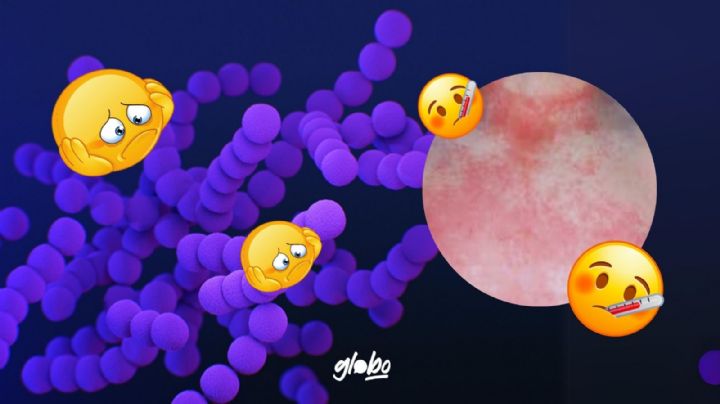 ¿Qué es la escarlatina y por qué da? Estos son los síntomas en niños	