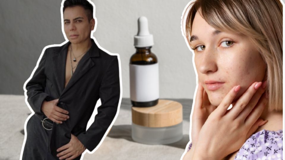 El famoso dermatólogo Javi Derma reveló los secretos para el cuidado de la piel con marcas