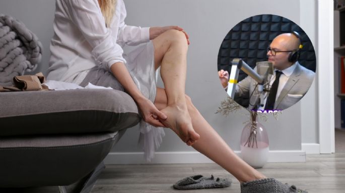 Descubre cómo identificar las várices con el doctor Abel Gutiérrez