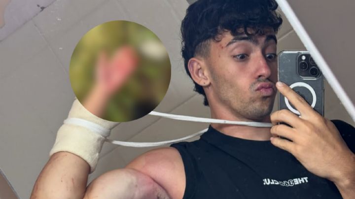 Gero Arias muestra el video del trágico accidente en el que perdió dos dedos