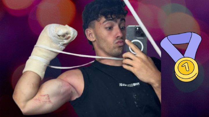 Gero Arias: ¿Cuál es el reto de 2025 que le hizo perder dos dedos tras un trágico accidente?