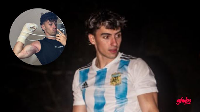 Gero Arias revela cómo le quedaron los dedos tras el accidente: "Están como..."