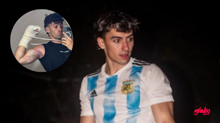 Gero Arias revela cómo le quedaron los dedos tras el accidente: "Están como..."