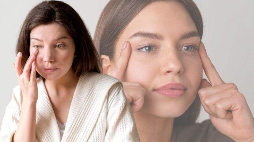 Patas de gallo después de los 50.