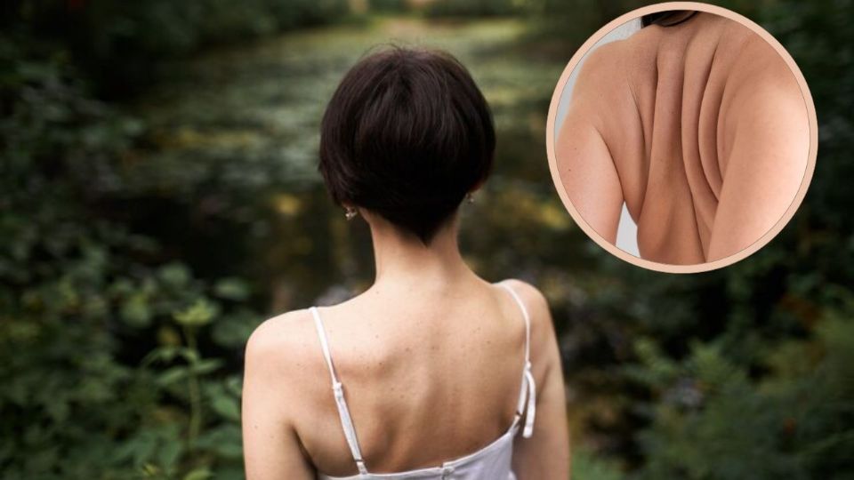 Eliminar los rollitos de la espalda no es una tarea imposible, pero sí requiere compromiso.